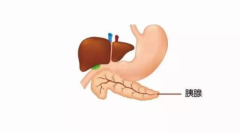 极易伪装的病——胰腺癌，出现这五个报警信号需注意！