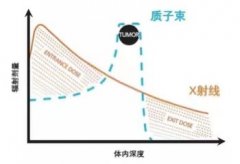 放疗“新秀”质子治疗，大幅度提高患者生活质量