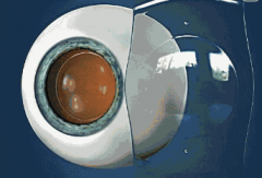 ICL晶体植入术为什么被称为近视手术的“天花板”