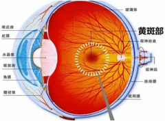 兰州爱尔陈雪艺：爸妈看不清，可能不是“老花”！这种眼底病变要当心
