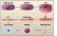 调控肿瘤细胞重编程，安罗替尼全新出击